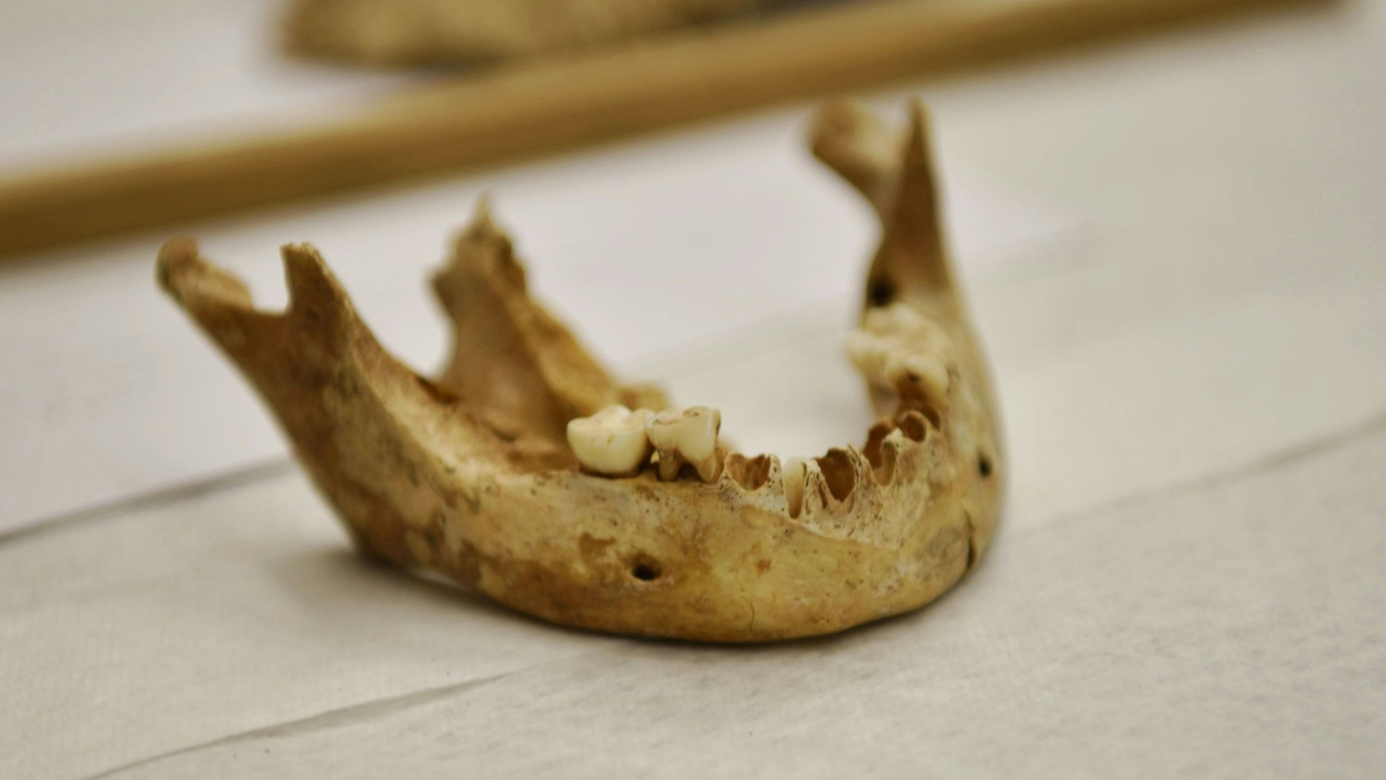 Auf einem mit Papier belegten Tablett liegt ein Kieferknochen eines Kindes, einige Zähne sind noch intakt.