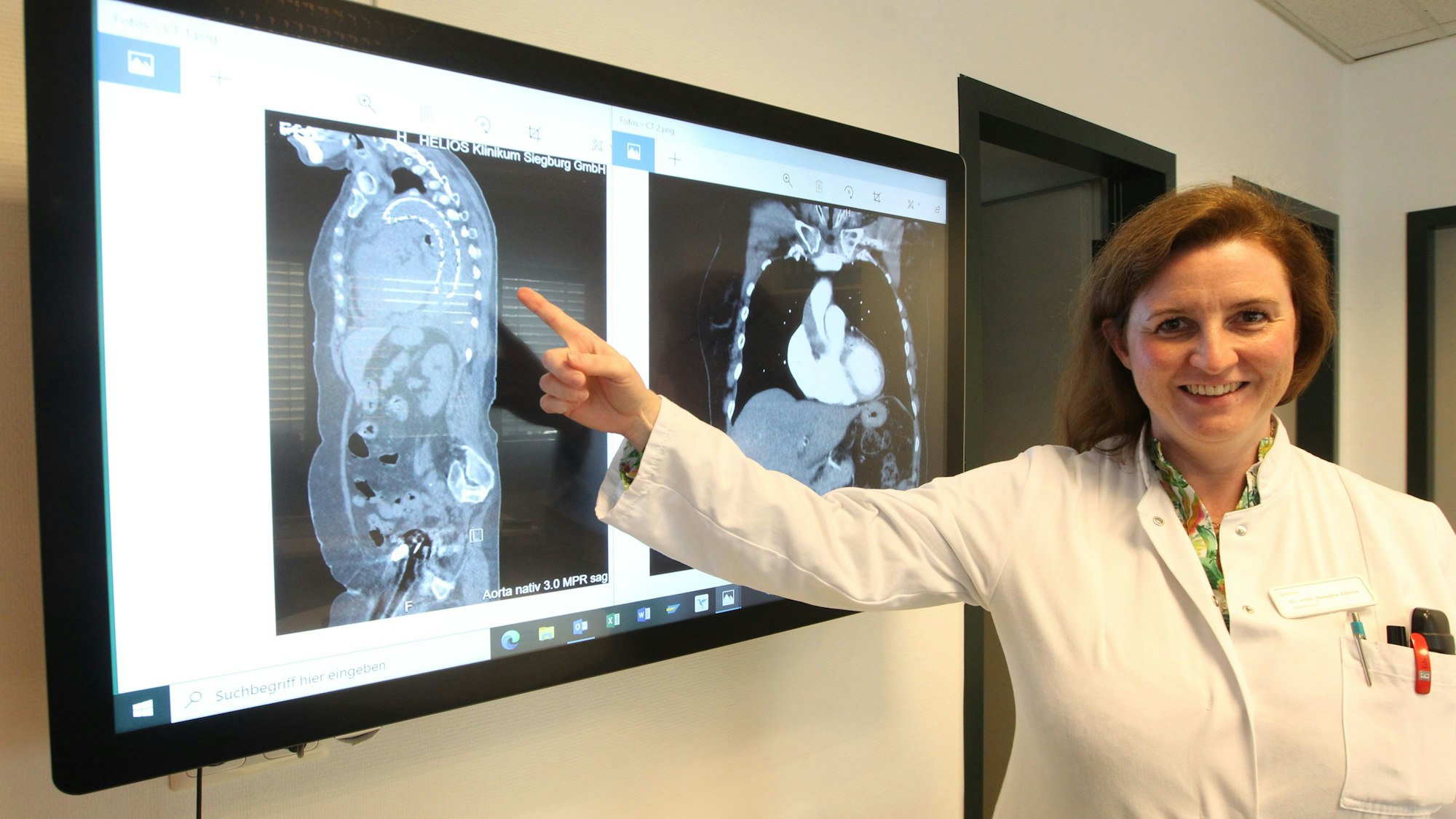 Eine Ärztin vor einer Leuchtwand mit Röntgenbildern.
