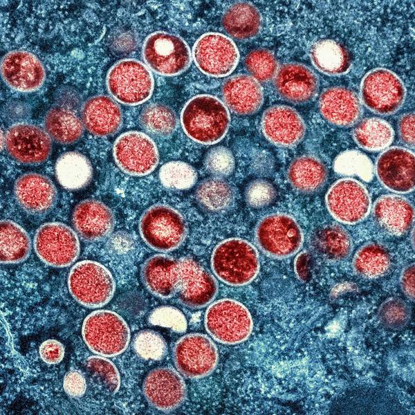 Eine eingefärbte Mikroskopaufnahme von Mpox-Partikeln (rot) in einer infizierten Zelle (blau), die im Labor kultiviert wurde. (Symbolbild)