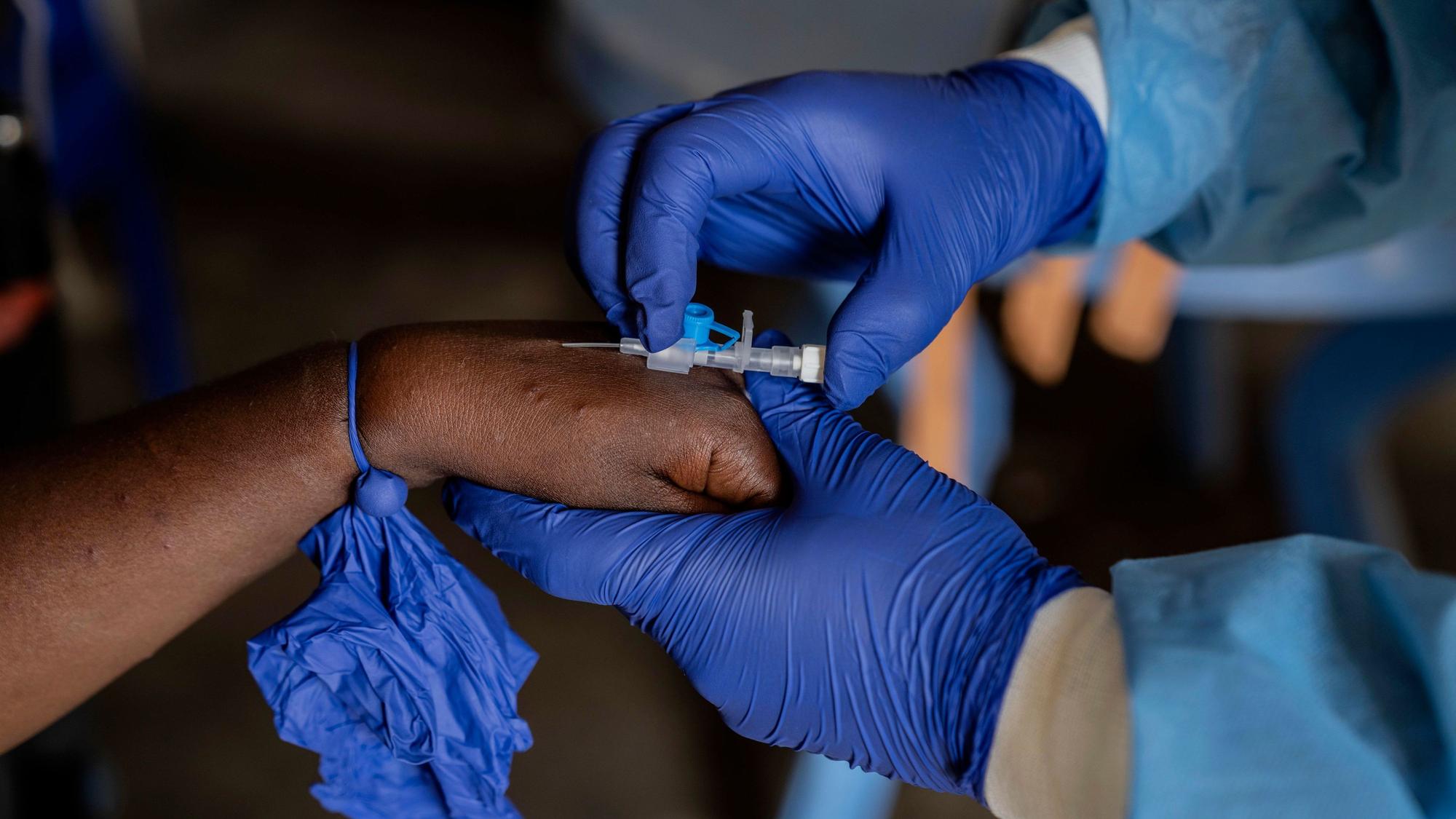 Ein Mitarbeiter des Gesundheitswesens kümmert sich um einen Mpox-Patienten in einem Behandlungszentrum im Kongo.
