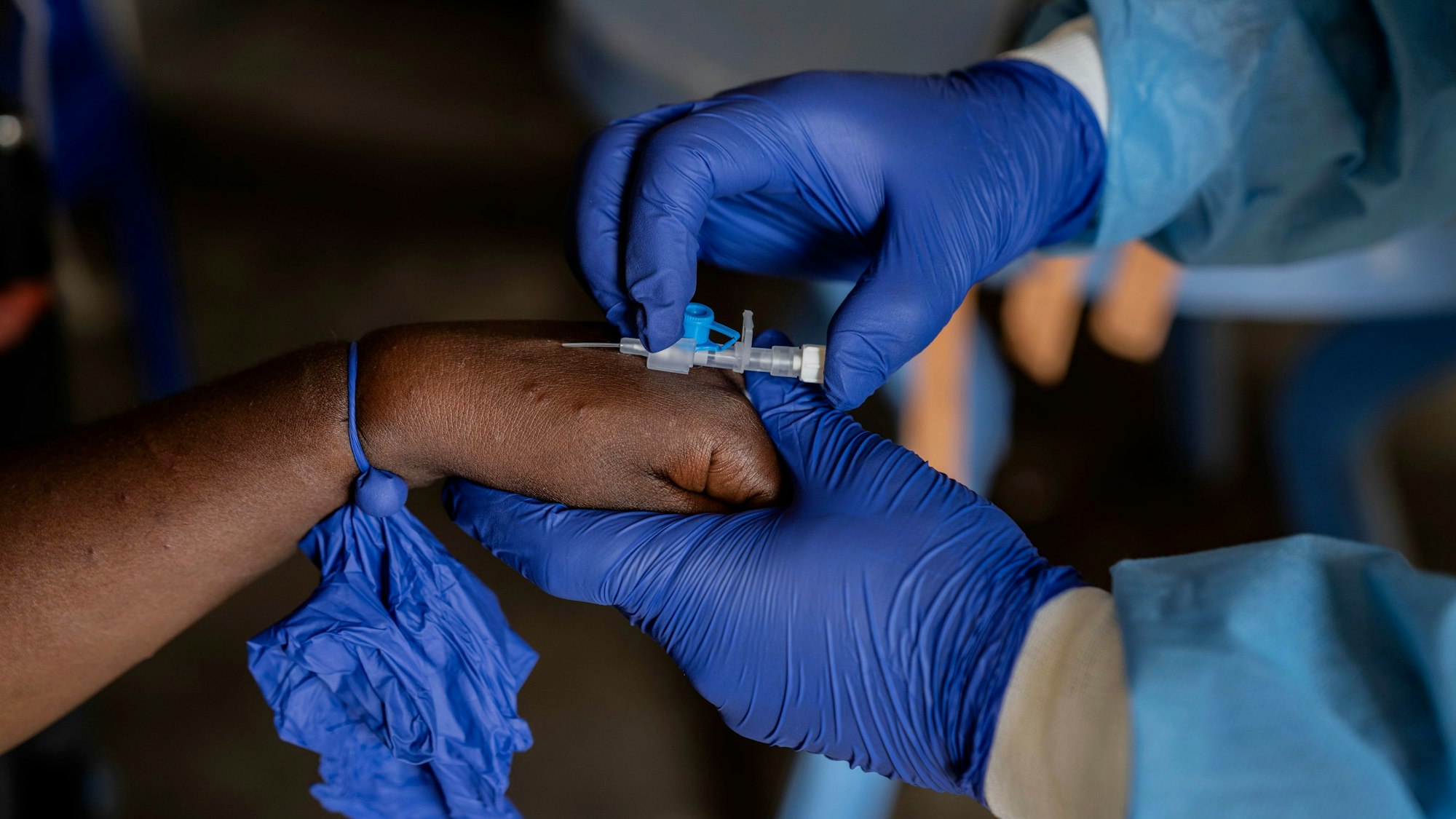 Ein Mitarbeiter des Gesundheitswesens kümmert sich um einen Mpox-Patienten in einem Behandlungszentrum im Kongo.