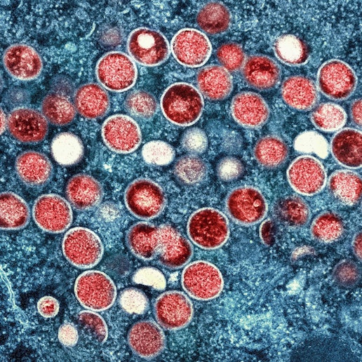 Eine eingefärbte Mikroskopaufnahme von mpox-Partikeln (rot) in einer infizierten Zelle (blau), die im Labor kultiviert wurde.