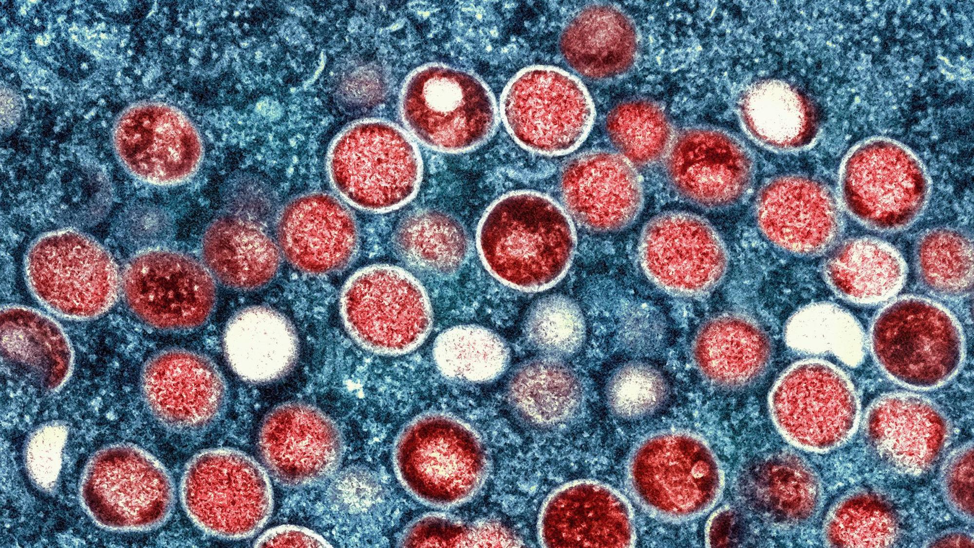 Eine eingefärbte Mikroskopaufnahme von mpox-Partikeln (rot) in einer infizierten Zelle (blau), die im Labor kultiviert wurde.