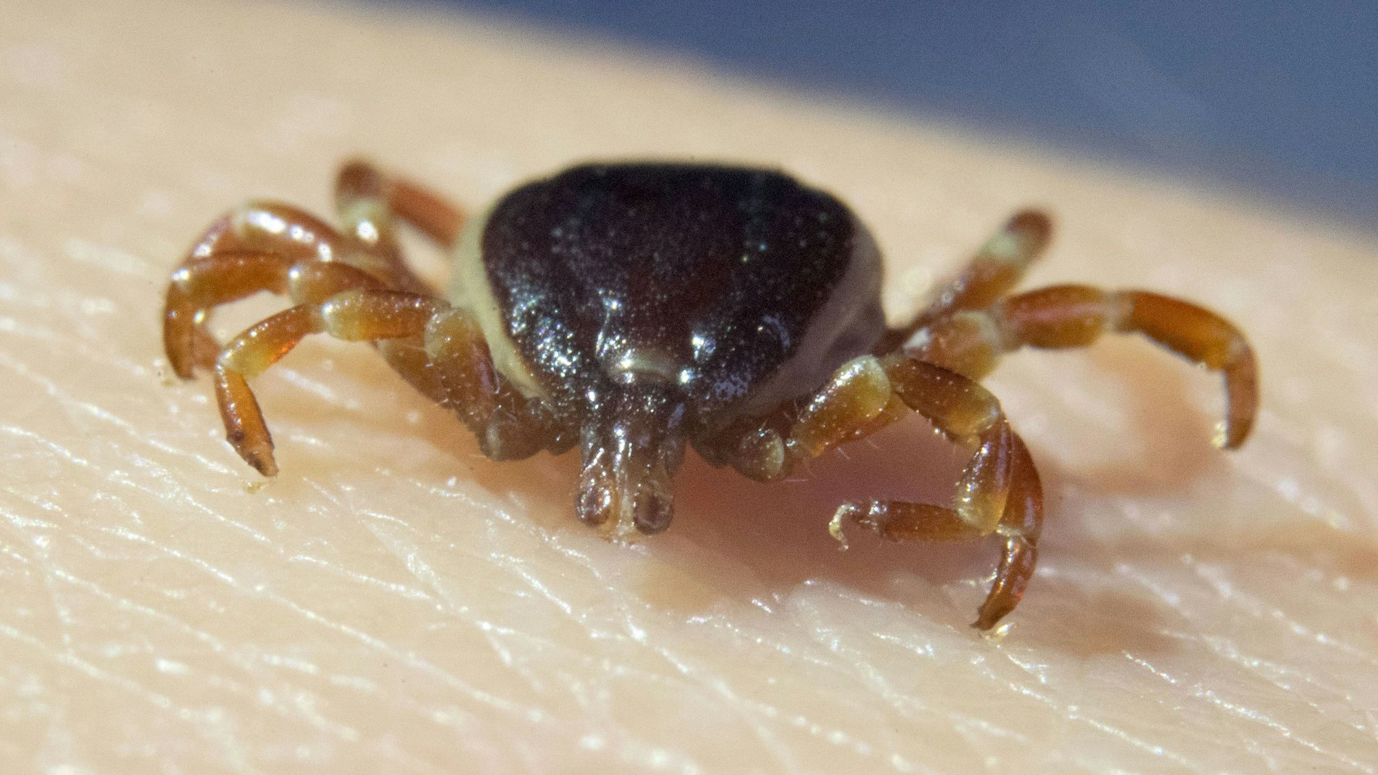 Eine tote Zecke „Hyalomma marginatum“ sitzt auf der Hand einer Doktorandin.