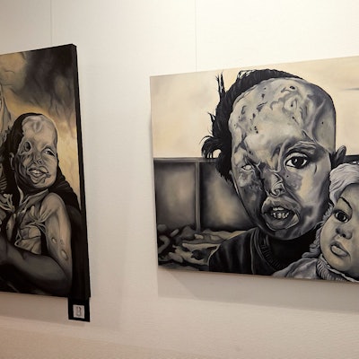 Bilder Sara Sheiky, die im Rathaus in Mechernich ausgestellt sind, zeigen durch Säureangriffe entstellte Gesichter von Frauen.