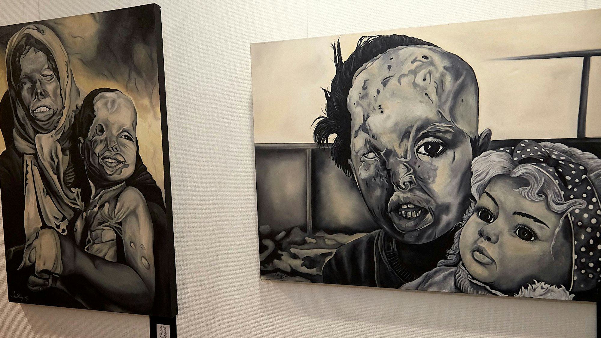 Bilder Sara Sheiky, die im Rathaus in Mechernich ausgestellt sind, zeigen durch Säureangriffe entstellte Gesichter von Frauen.