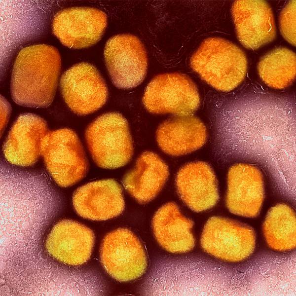 Eine kolorierte transmissionselektronenmikroskopische Aufnahme von Partikeln des Affenpockenvirus (Gold), kultiviert und gereinigt aus einer Zellkultur, aufgenommen in der NIAID Integrated Research Facility, veröffentlicht am 26. Juli 2022, in Fort Detrick, Maryland.