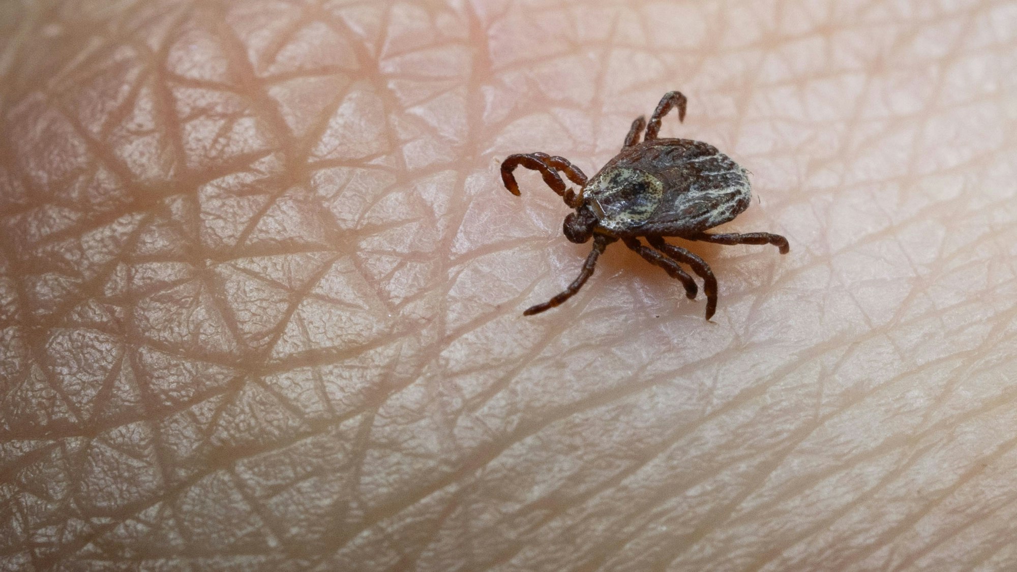 ARCHIV - 20.02.2024, Baden-Württemberg, Stuttgart: Unerwünschte Begegnung: Wer viel draußen unterwegs ist, kann den Kontakt mit Zecken nicht immer vermeiden. (zu dpa: «FSME-Fälle in Sachsen-Anhalt auf Vorjahresniveau») Foto: Marijan Murat/dpa +++ dpa-Bildfunk +++