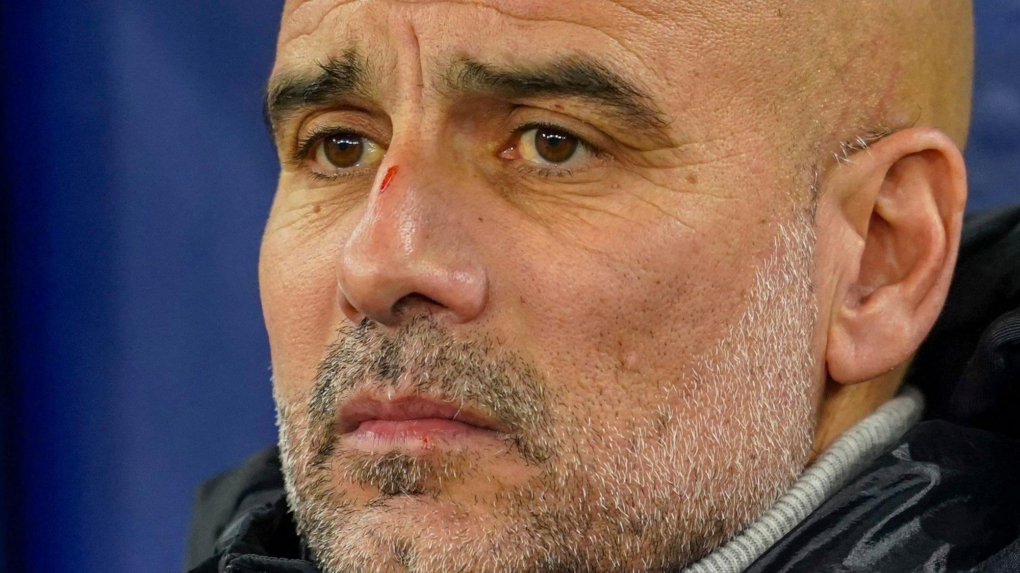Die Krise von Manchester City und Trainer Pep Guardiola wird immer größer.