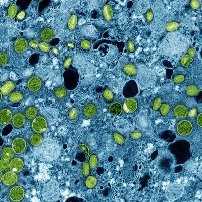 Diese kolorierte elektronenmikroskopische Aufnahme aus dem Jahr 2024 zeigt Mpox-Viruspartikel (grün), die sich in infizierten kultivierten Zellen (blau) befinden.