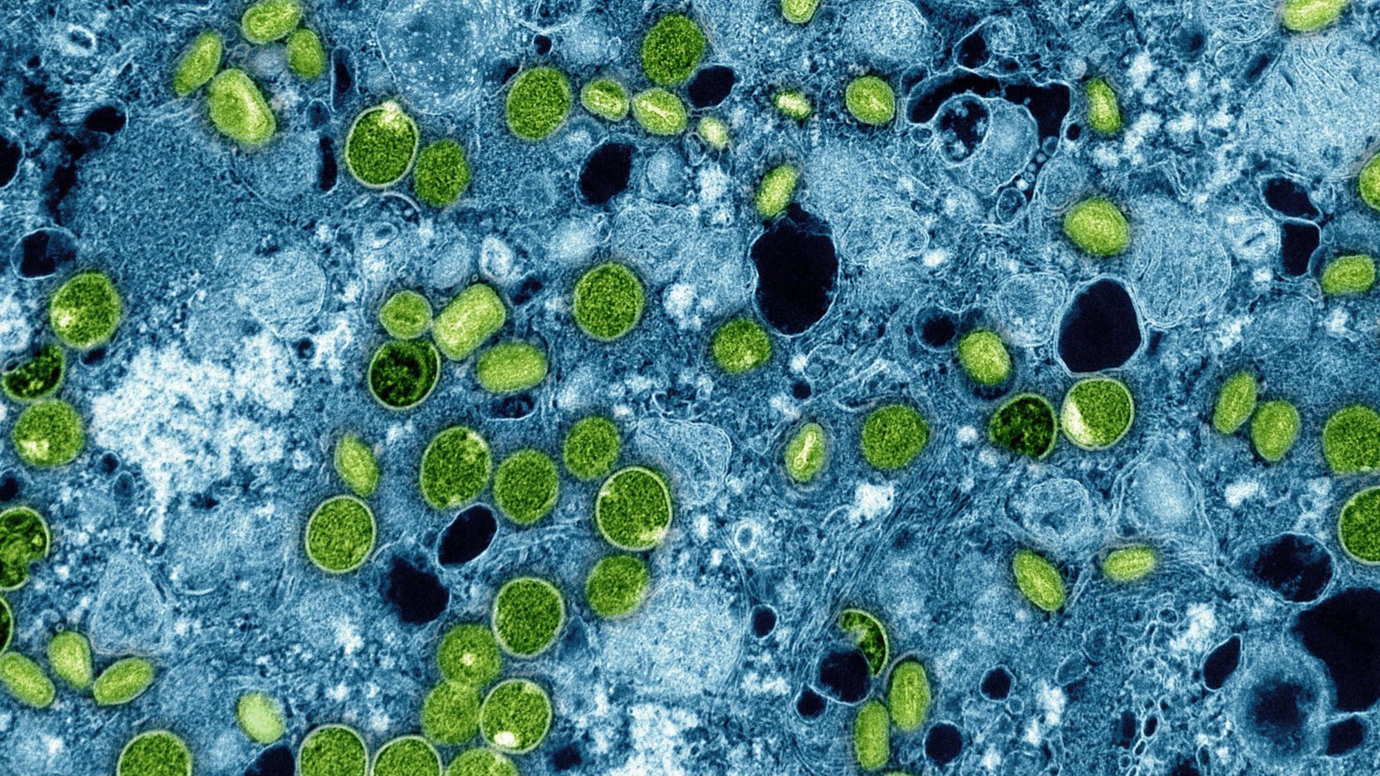 Diese kolorierte elektronenmikroskopische Aufnahme aus dem Jahr 2024 zeigt Mpox-Viruspartikel (grün), die sich in infizierten kultivierten Zellen (blau) befinden.