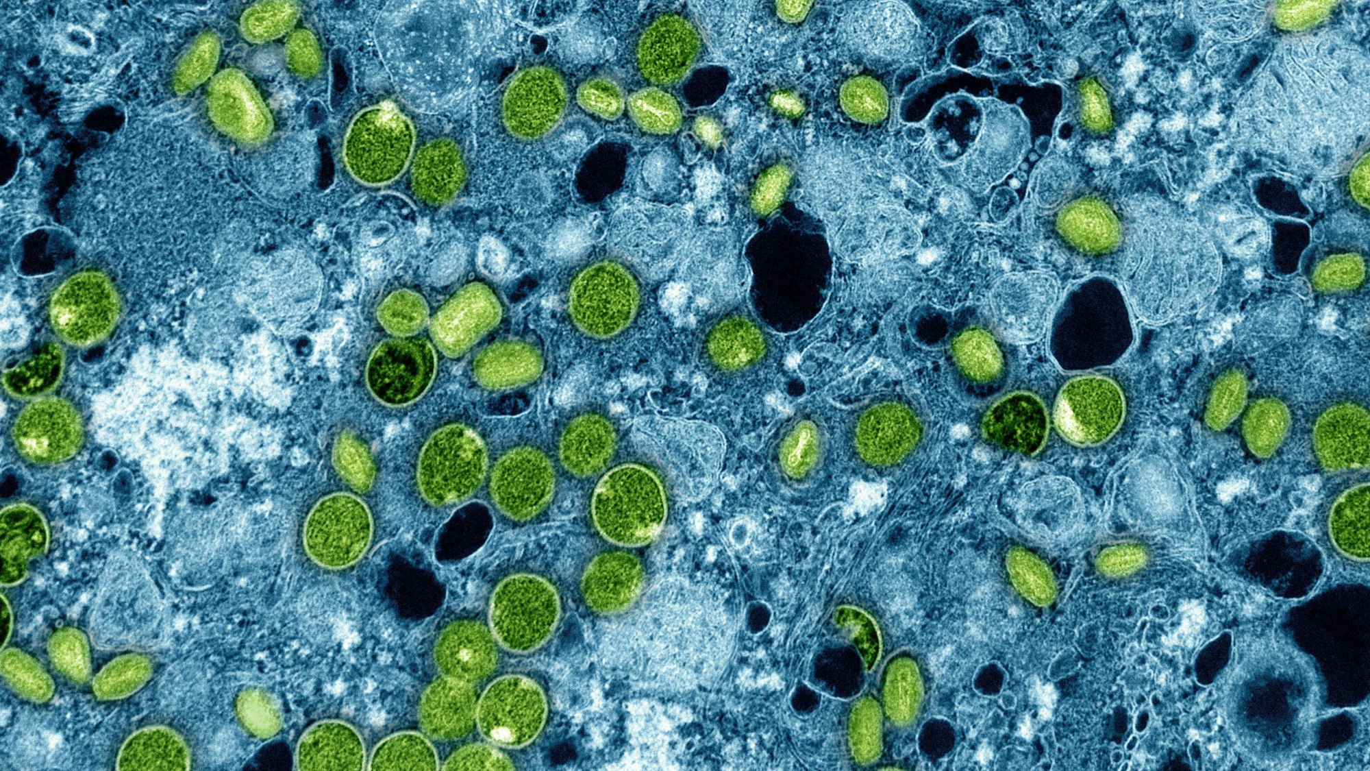 Diese kolorierte elektronenmikroskopische Aufnahme aus dem Jahr 2024 zeigt Mpox-Viruspartikel (grün), die sich in infizierten kultivierten Zellen (blau) befinden.