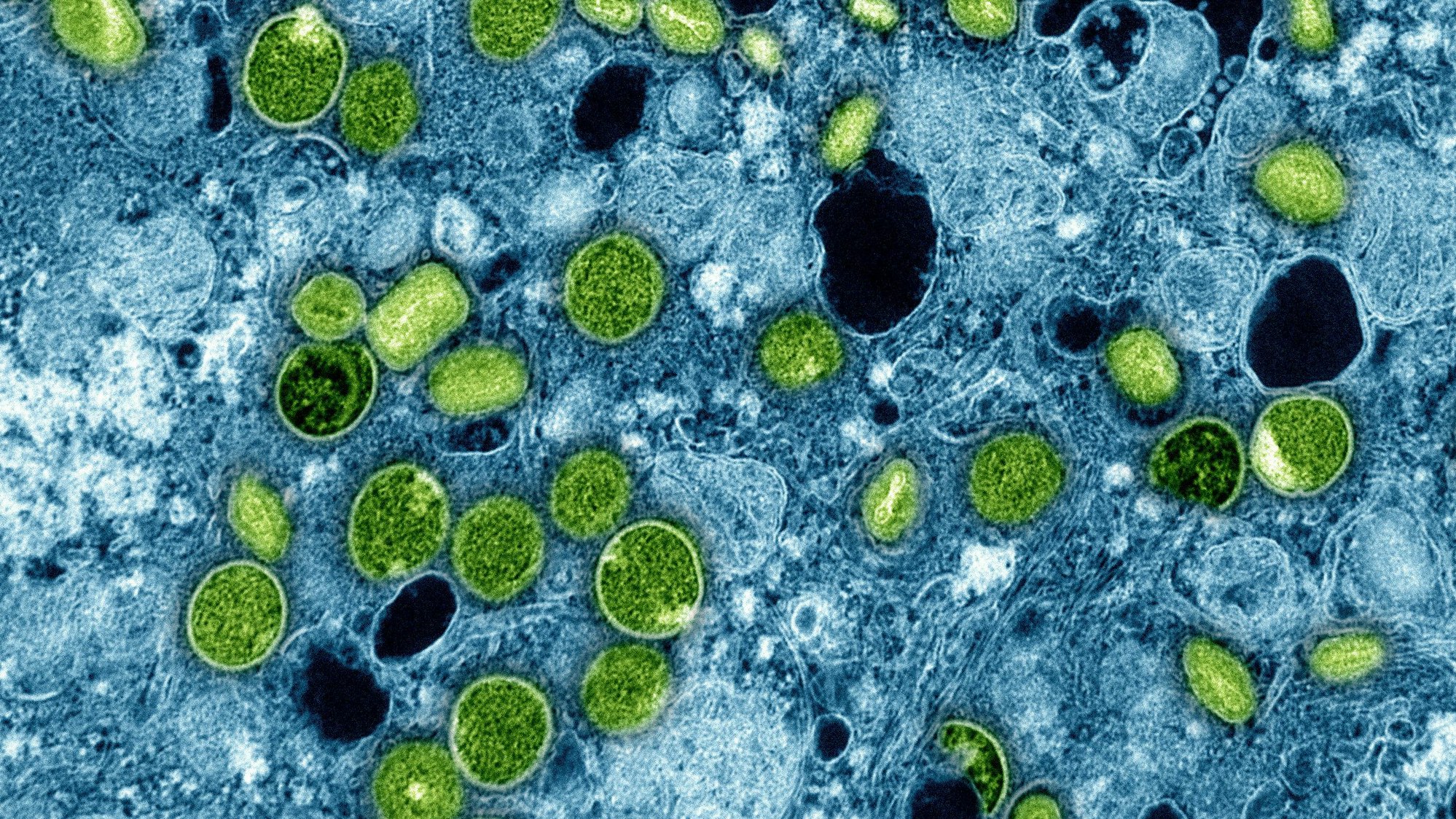 Diese kolorierte elektronenmikroskopische Aufnahme des National Institute of Allergy and Infectious Diseases aus dem Jahr 2024 zeigt Mpox-Viruspartikel (grün), die sich in infizierten kultivierten Zellen (blau) befinden. Die Viruspartikel befinden sich in verschiedenen Reifestadien, was zu Unterschieden in der Form führt.