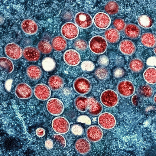 Eine kolorierte transmissionselektronenmikroskopische Aufnahme von Partikeln des Virus in einer infizierten Zelle, die im Labor gezüchtet und in der NIAID Integrated Research Facility aufgenommen wurde.