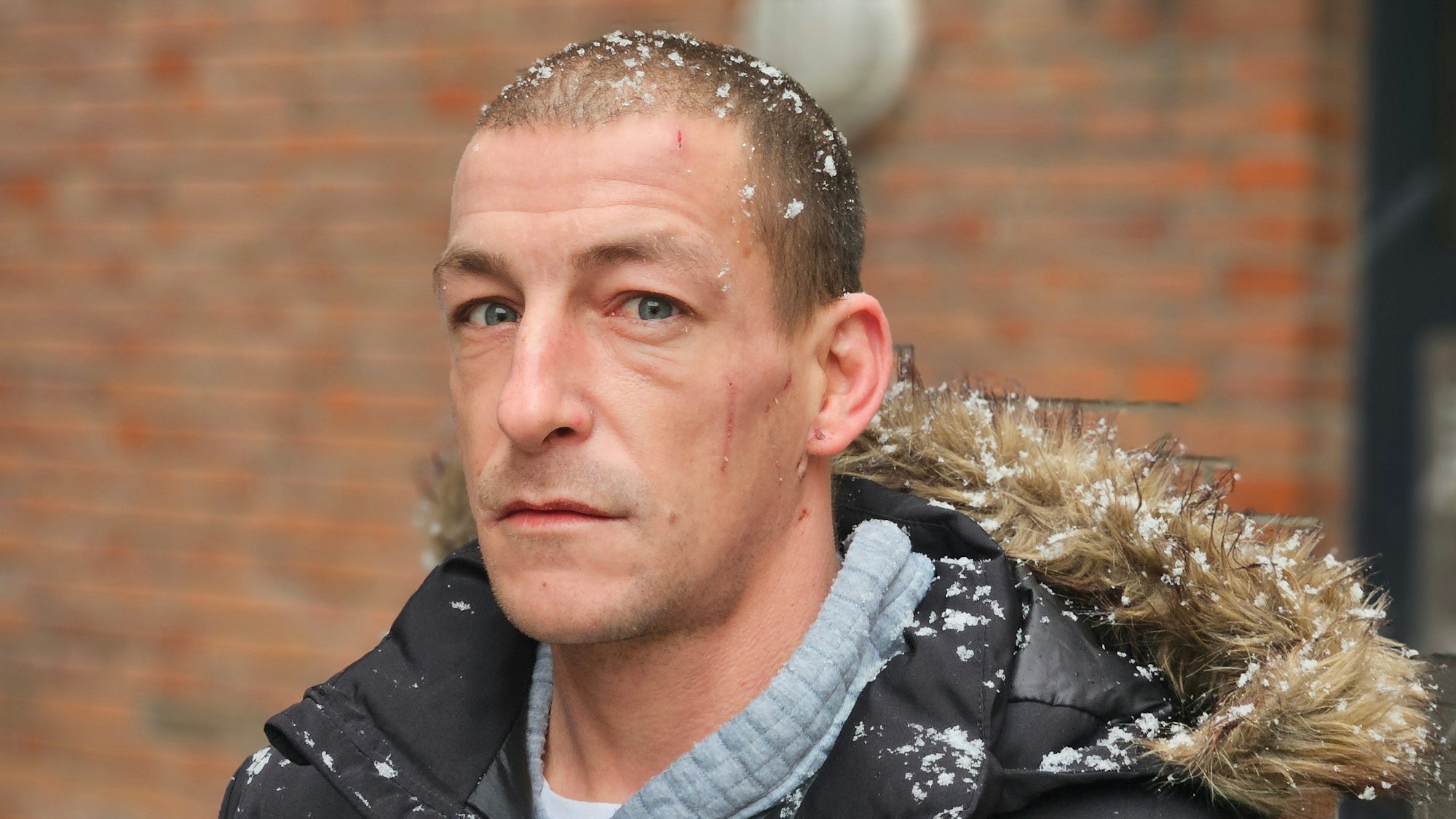 Marcel Vogler erlitt nach eigenen Angaben eine Platzwunde und Blutergüsse. Die Platzwunde ist noch immer auf seiner Stirn zu sehen.