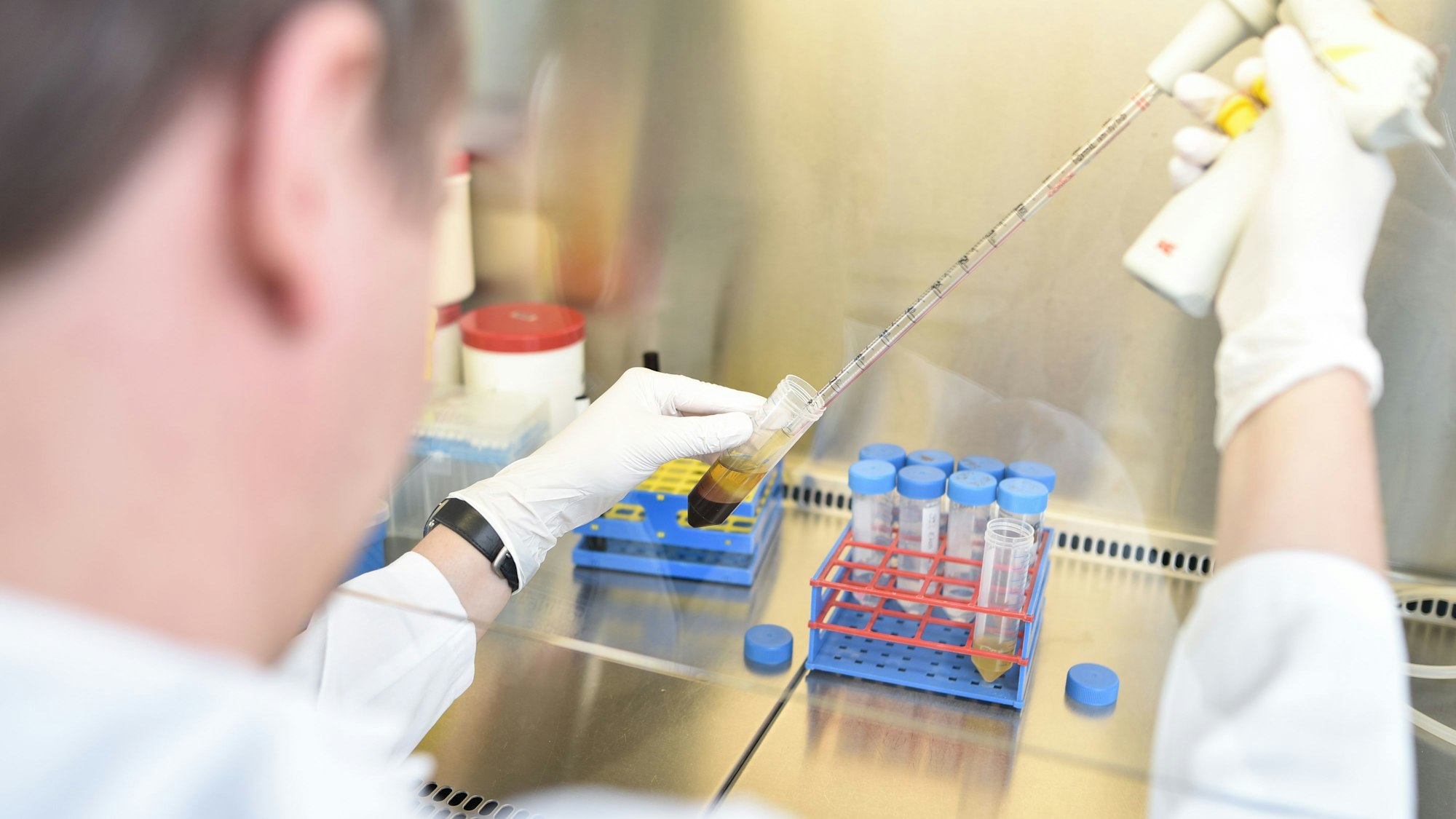 Ein Krebsforscher arbeitet in einem Labor des Nationalen Centrums für Tumorerkrankungen mit einer Pipette.