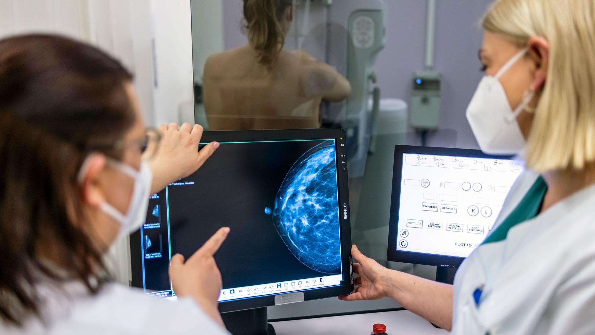 Brustkrebs ist in Deutschland die häufigste Krebserkrankung bei Frauen. Weit über 70.000 erhalten laut dem Deutschen Krebsforschungszentrum jährlich die Diagnose.