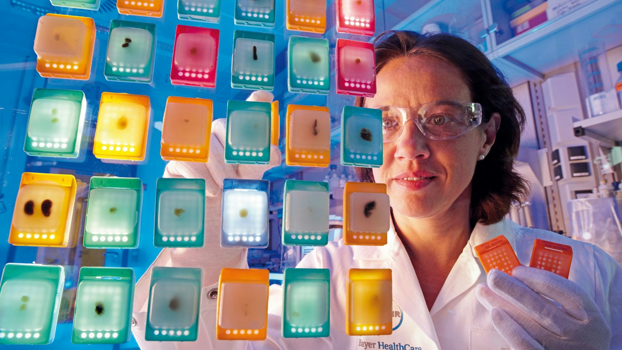 Sichtung von Gewebepräparate mit Tumorproben zunächst mit bloßem Auge. Die Entwicklung von Krebsmedikamenten ist ein Schwerpunkt der Pharma-Sparte von Bayer.