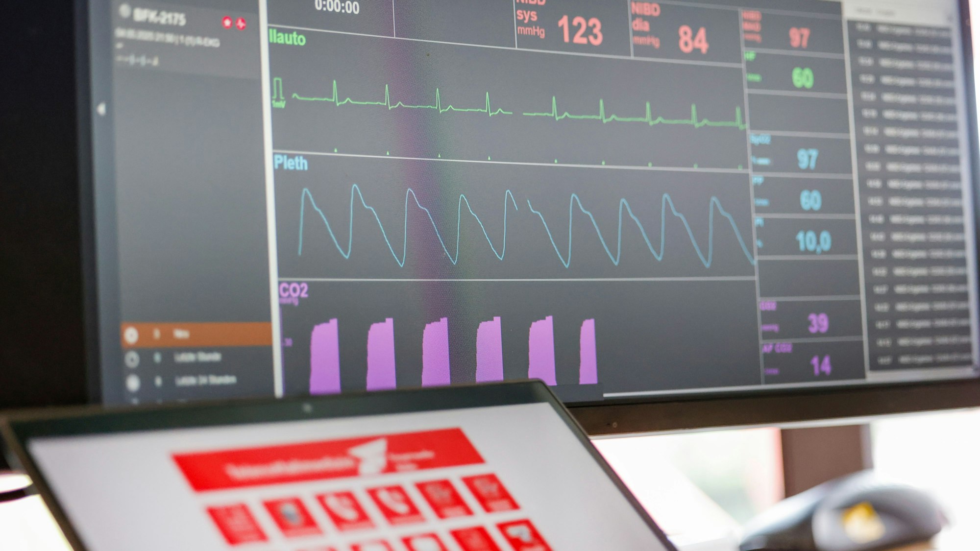 Auf ihrem Computer können die Telenotärzte die Daten des EKGs im Rettungswagen empfangen – denn das Medizingerät ist telemetriefähig.