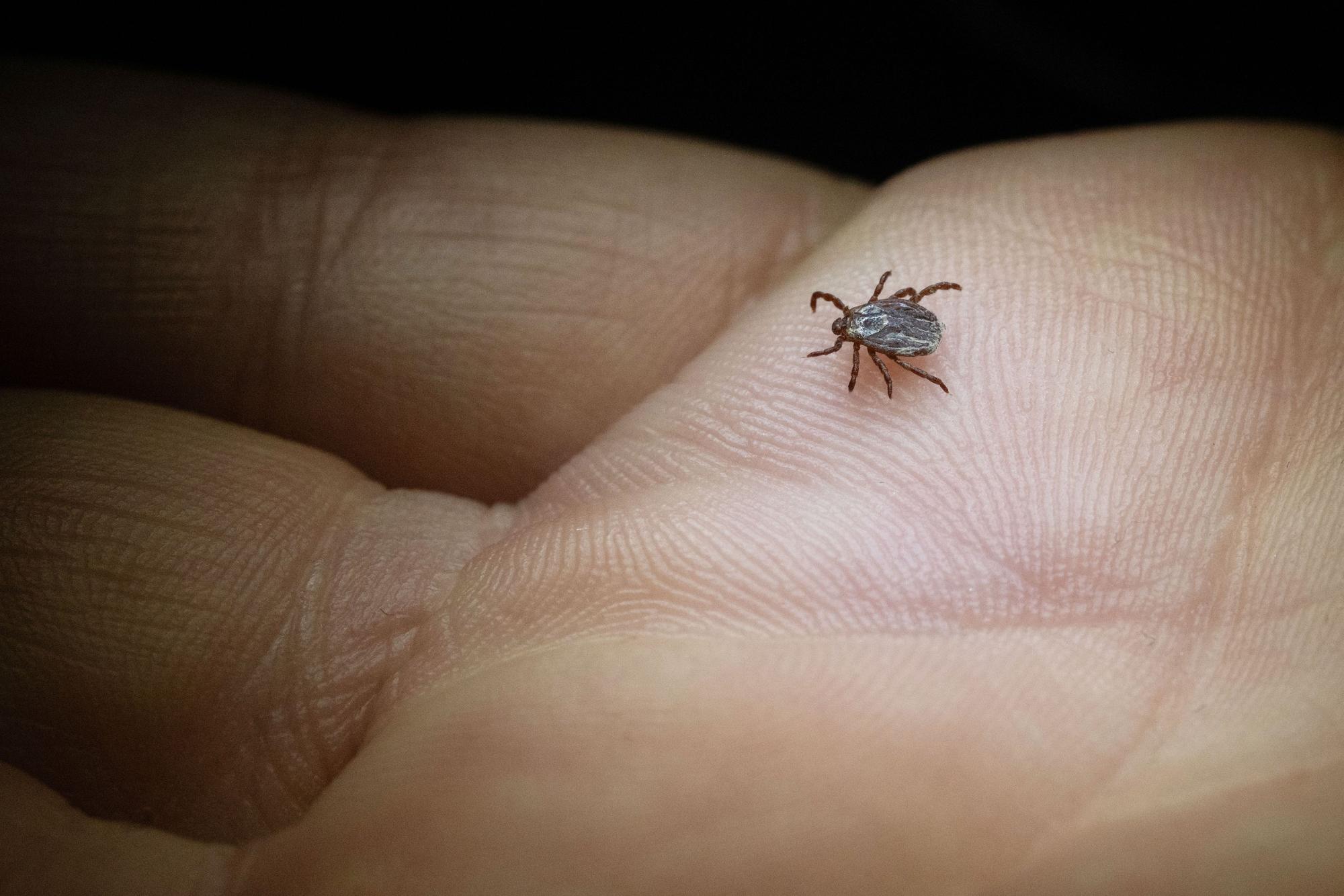 ILLUSTRATION - Zecken suchen am Körper nach geschützten Stellen, um zuzustechen. So fühlen sie sich unter den Achseln oder hinter dem Ohr wohl. (zu dpa: «Zeckenzeit: Wie erkenne ich Borreliose?») Foto: Marijan Murat/dpa/dpa-tmn - Honorarfrei nur für Bezieher des dpa-Themendienstes +++ dpa-Themendienst +++