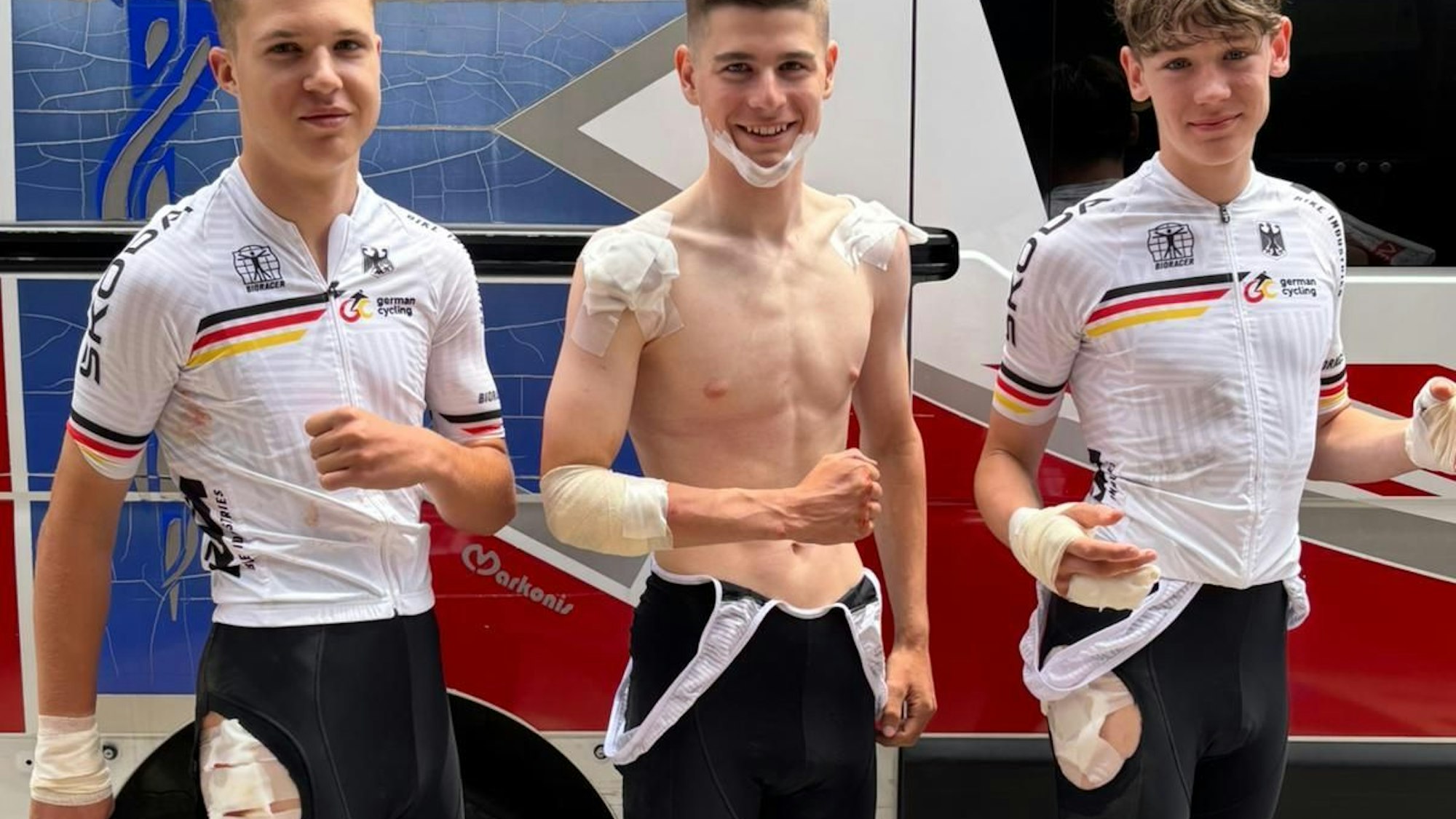 Drei junge Rennradfahrer stehen vor einem Rettungswagen. Alle drei haben Verbände über ihren Schürfwunden an den unterschiedlichsten Körperteilen.