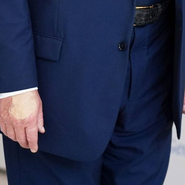 22.08.2025, USA, Washington: Die Hand von US-Präsident Donald Trump, während er im Museum The People's House spricht. Foto: Evan Vucci/AP/dpa +++ dpa-Bildfunk +++