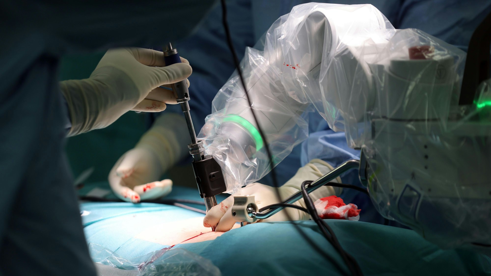 „Mazor“ hält den Bohrer des Chirurgen wie ein perfekter Assistent in der richtigen Position.