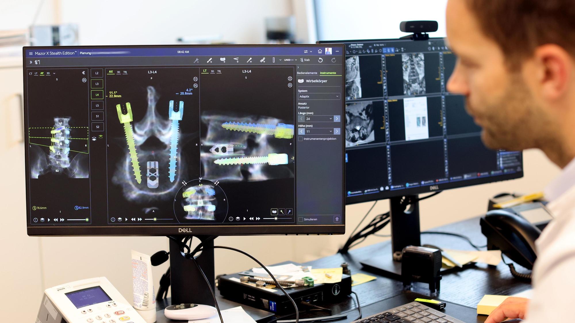 Digitale Planung: Dr. Bredow bereitet mit der Software des Roboters die Operation vor.