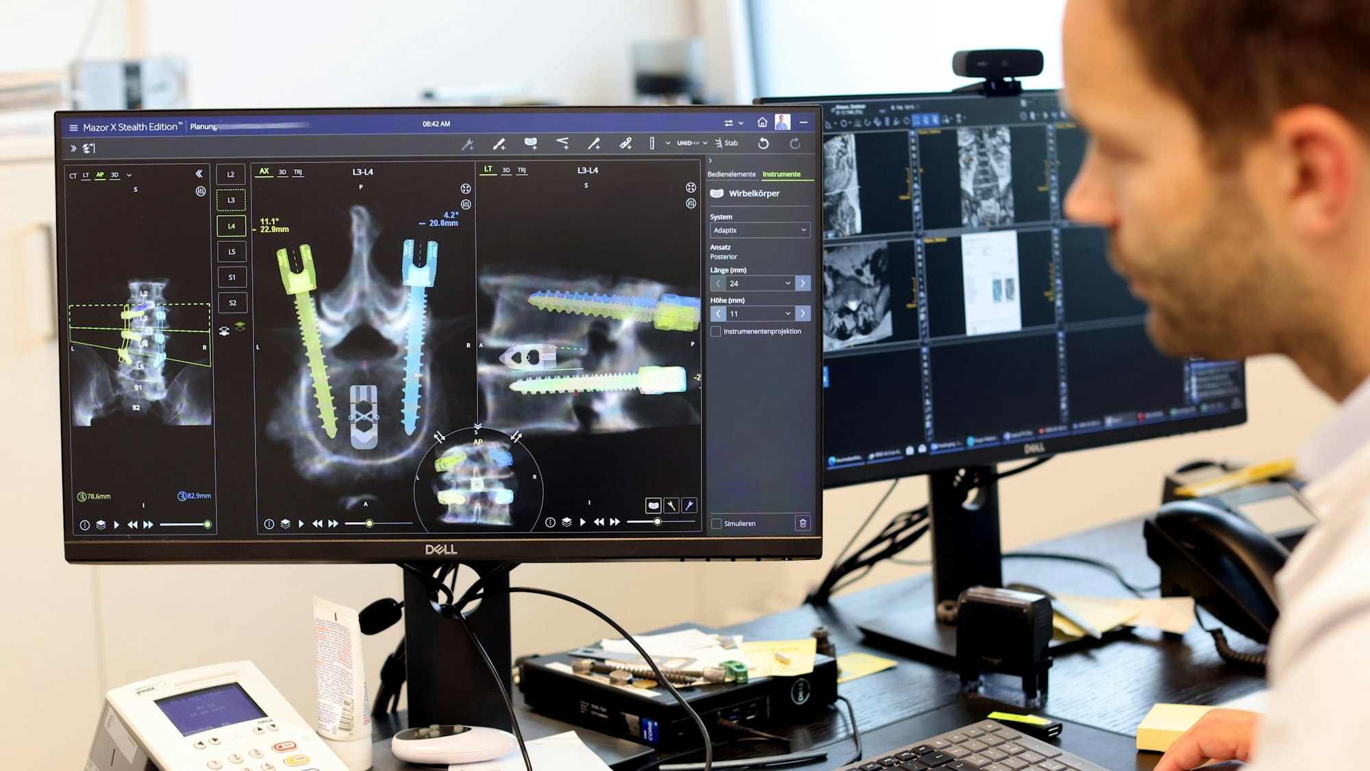 Digitale Planung: Dr. Bredow bereitet mit der Software des Roboters die Operation vor.