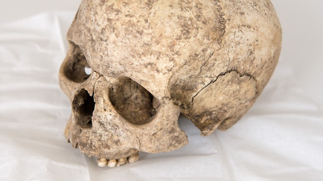 Der Schädel eines Menschen (Symbolbild)