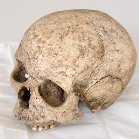 Der Schädel eines Menschen (Symbolbild)