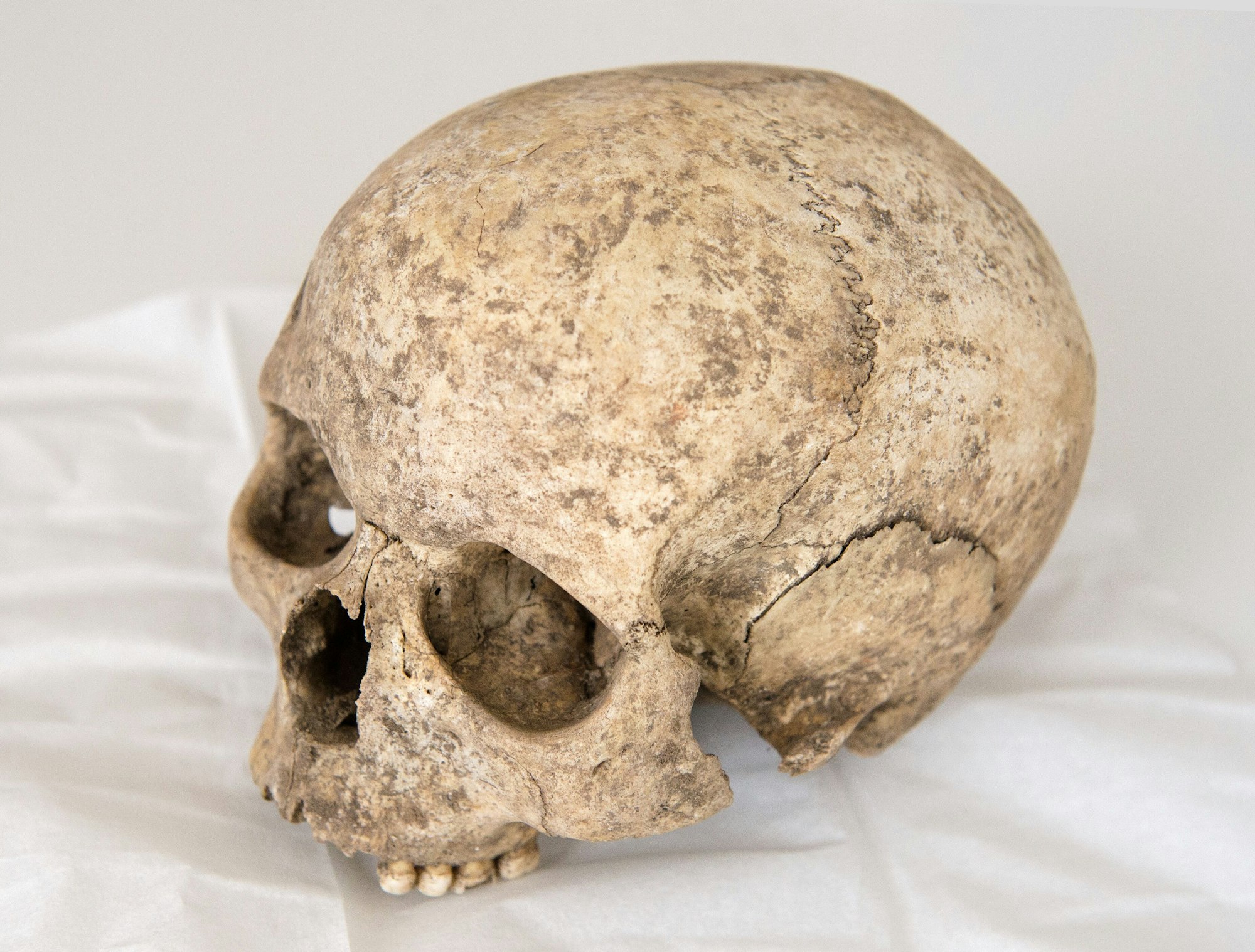 Der Schädel eines Menschen (Symbolbild)