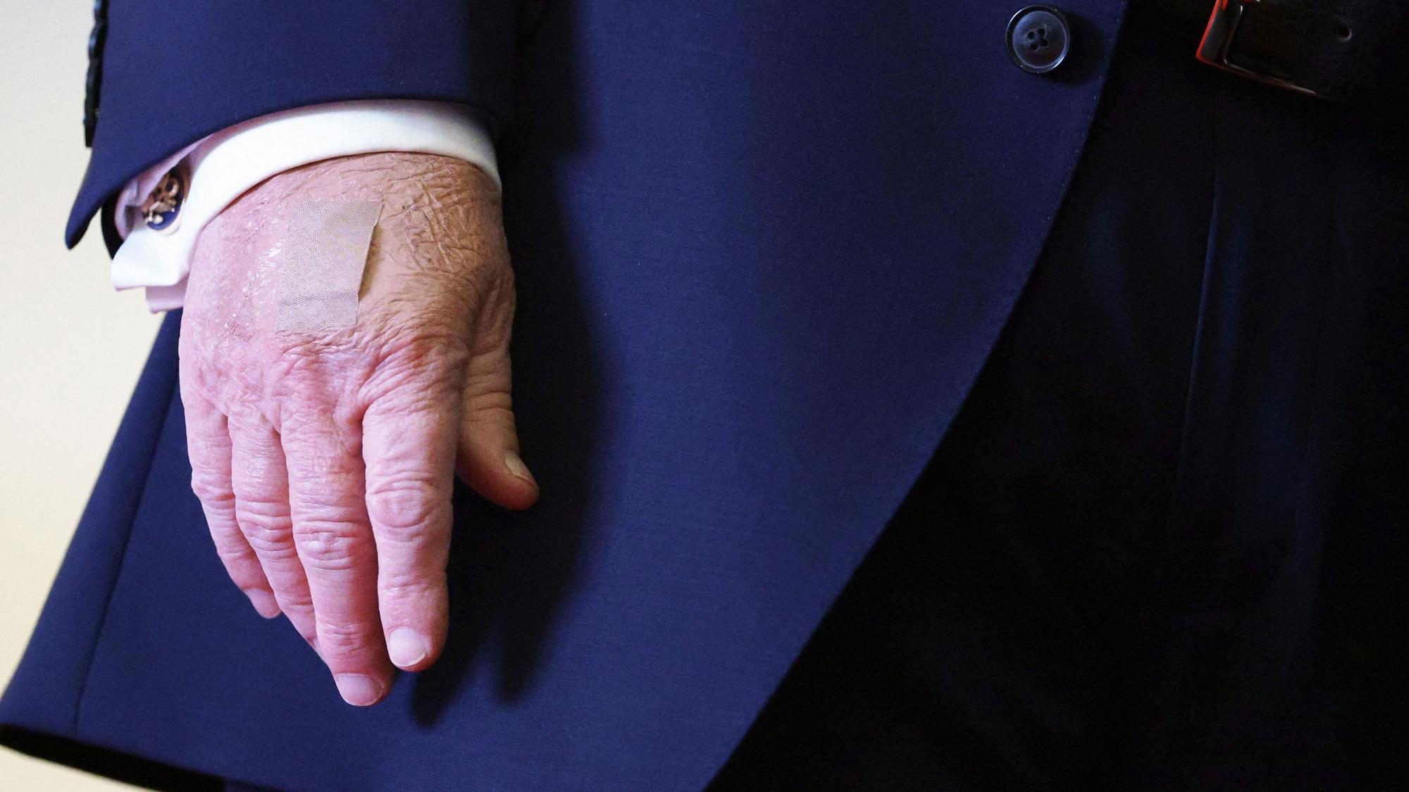 Blutergüsse und Pflaster auf der Hand von Donald Trump sorgen immer wieder für Spekulationen um seinen Gesundheitszustand. Auch am 9. Dezember trat Trump mit Make-up und Pflaster auf der Hand auf.