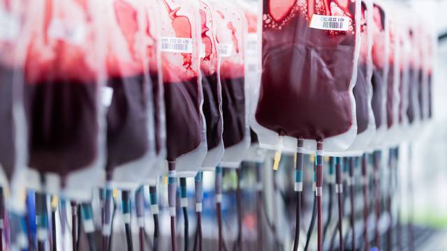 Bis zu 40 Prozent weniger Blutkonserven kann das Deutsche Rote Kreuz laut einem Sprecher an Kölner Kliniken liefern.