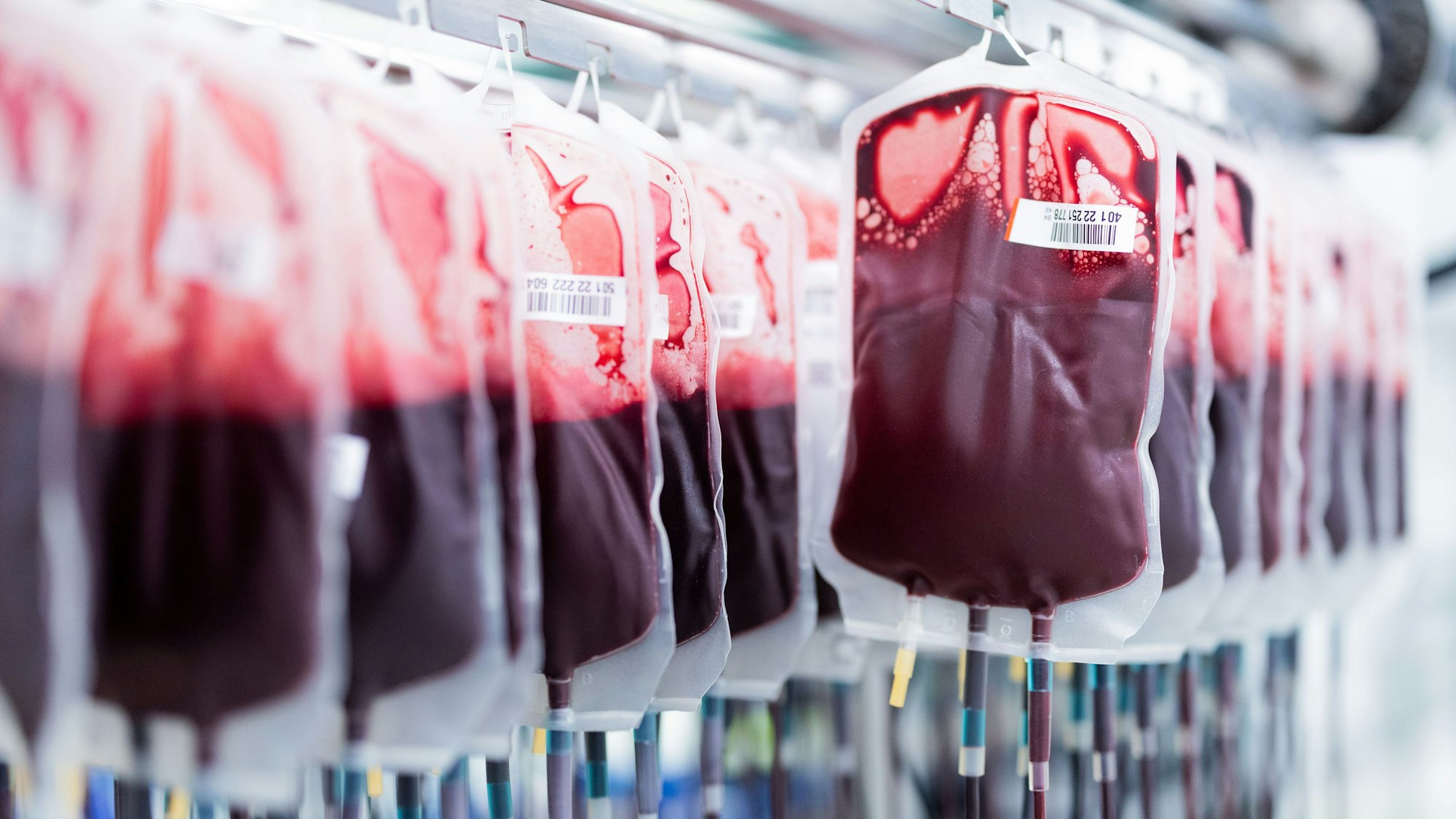 Bis zu 40 Prozent weniger Blutkonserven kann das Deutsche Rote Kreuz laut einem Sprecher an Kölner Kliniken liefern.