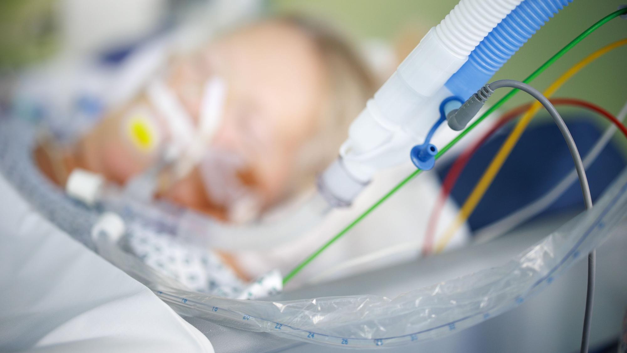 Beatmungsschläuche sind vor einem intubierten Patienten in einem Intensivbett-Zimmer zu sehen.