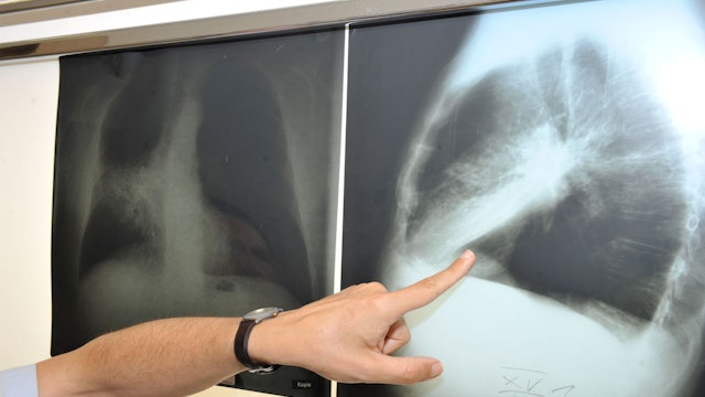 Im Winter weniger zu lüften, kann die Belastung mit krebserregendem Radon in der Wohnung erhöhen. (Archivbild)