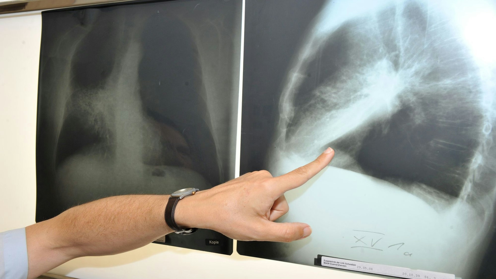 Im Winter weniger zu lüften, kann die Belastung mit krebserregendem Radon in der Wohnung erhöhen. (Archivbild)