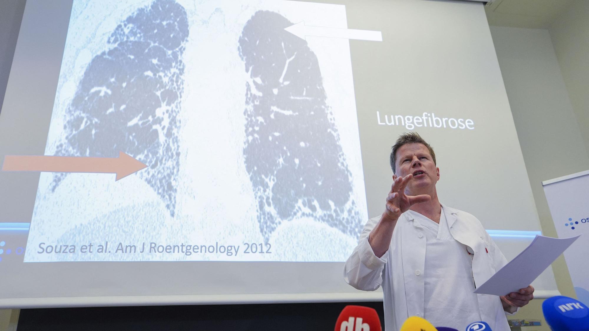 Lungenspezialist Are Holm äußert sich am Freitag (5. Juni) zur Erkrankung von Kronprinzessin Mette-Marit.