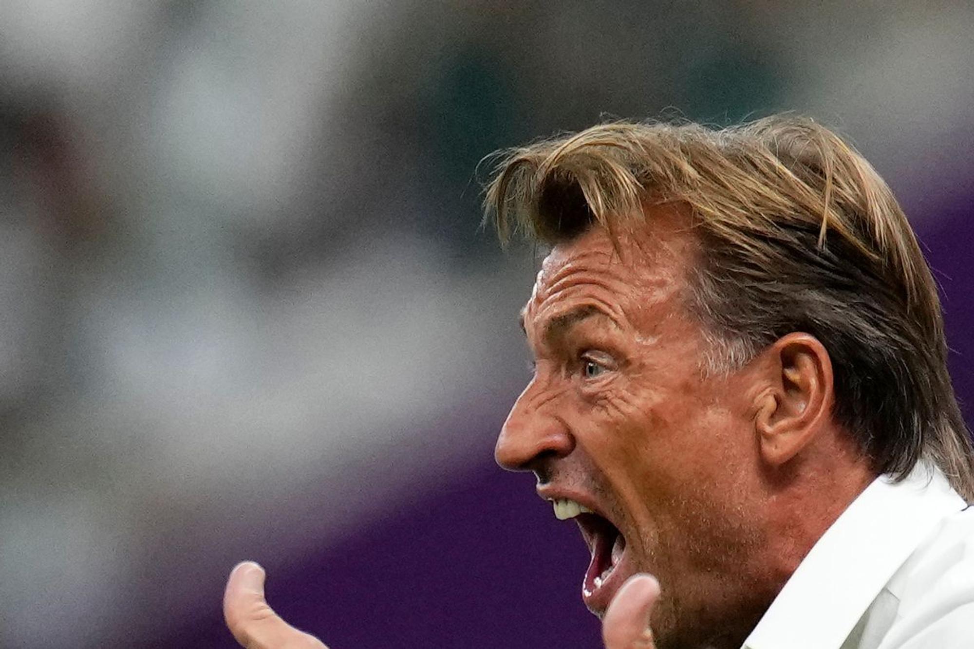 Hervé Renard