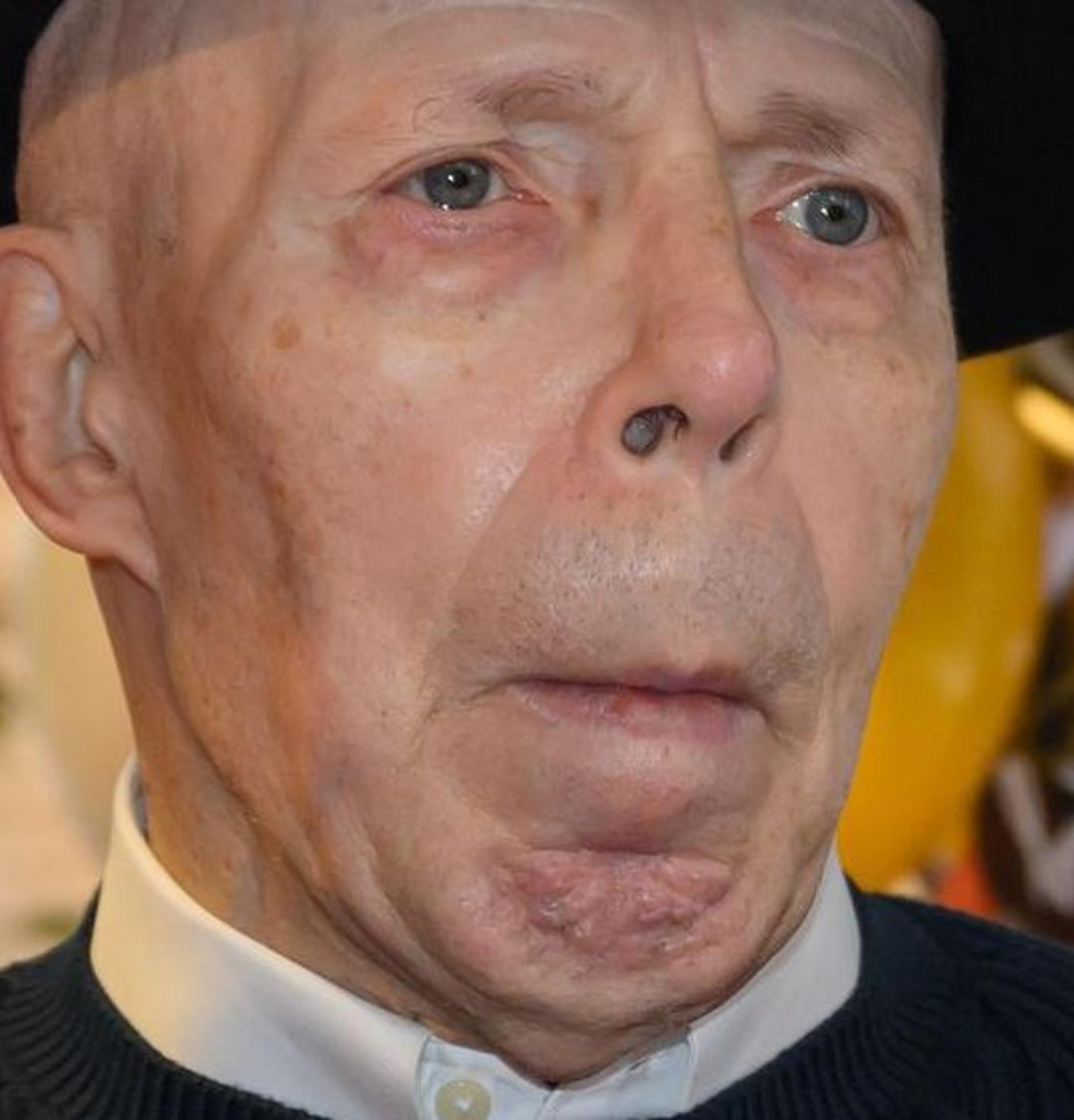 Gunther von Hagens