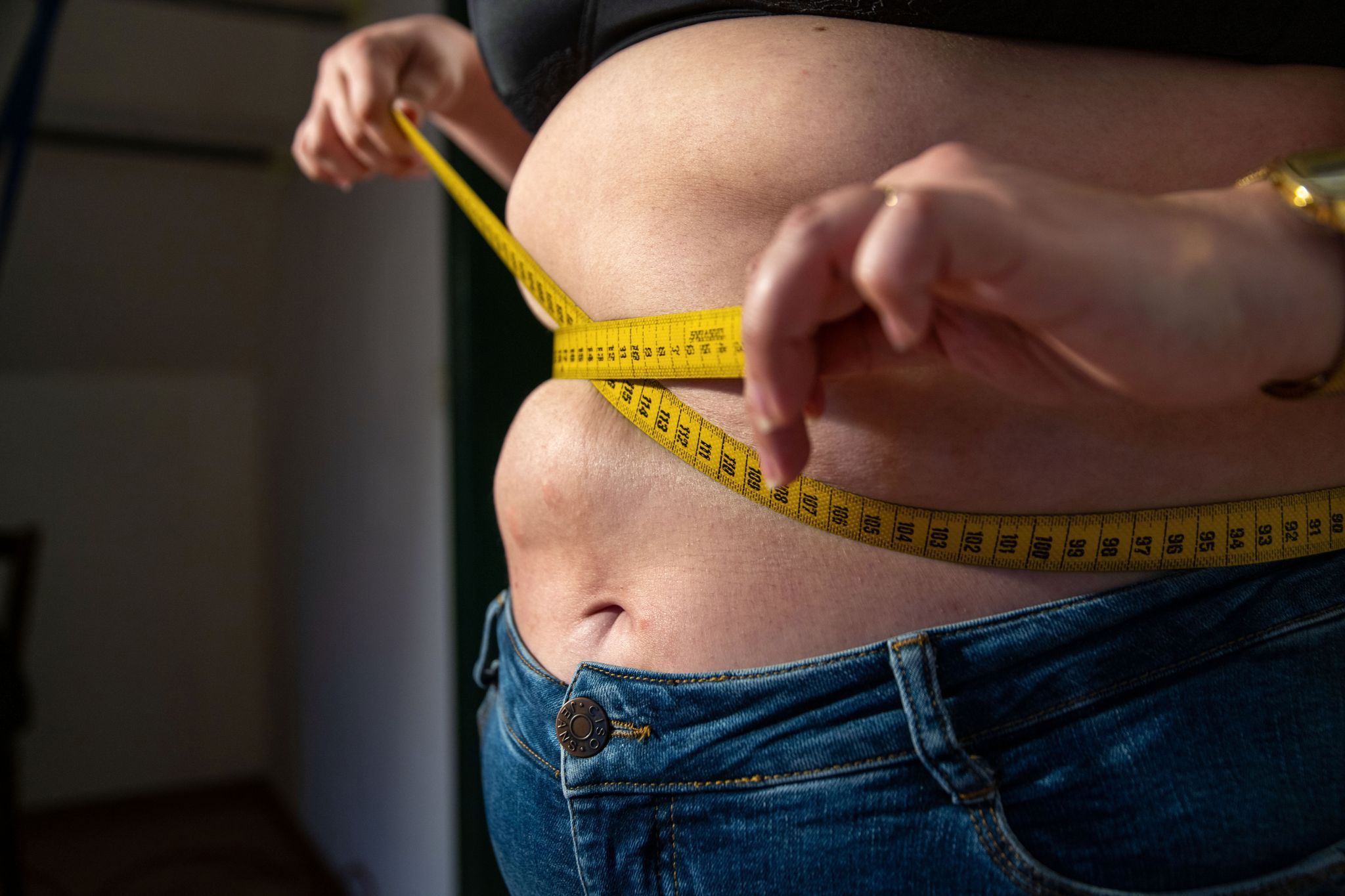 Eine Frau mit Übergewicht hält ein Maßband um ihren Bauch.