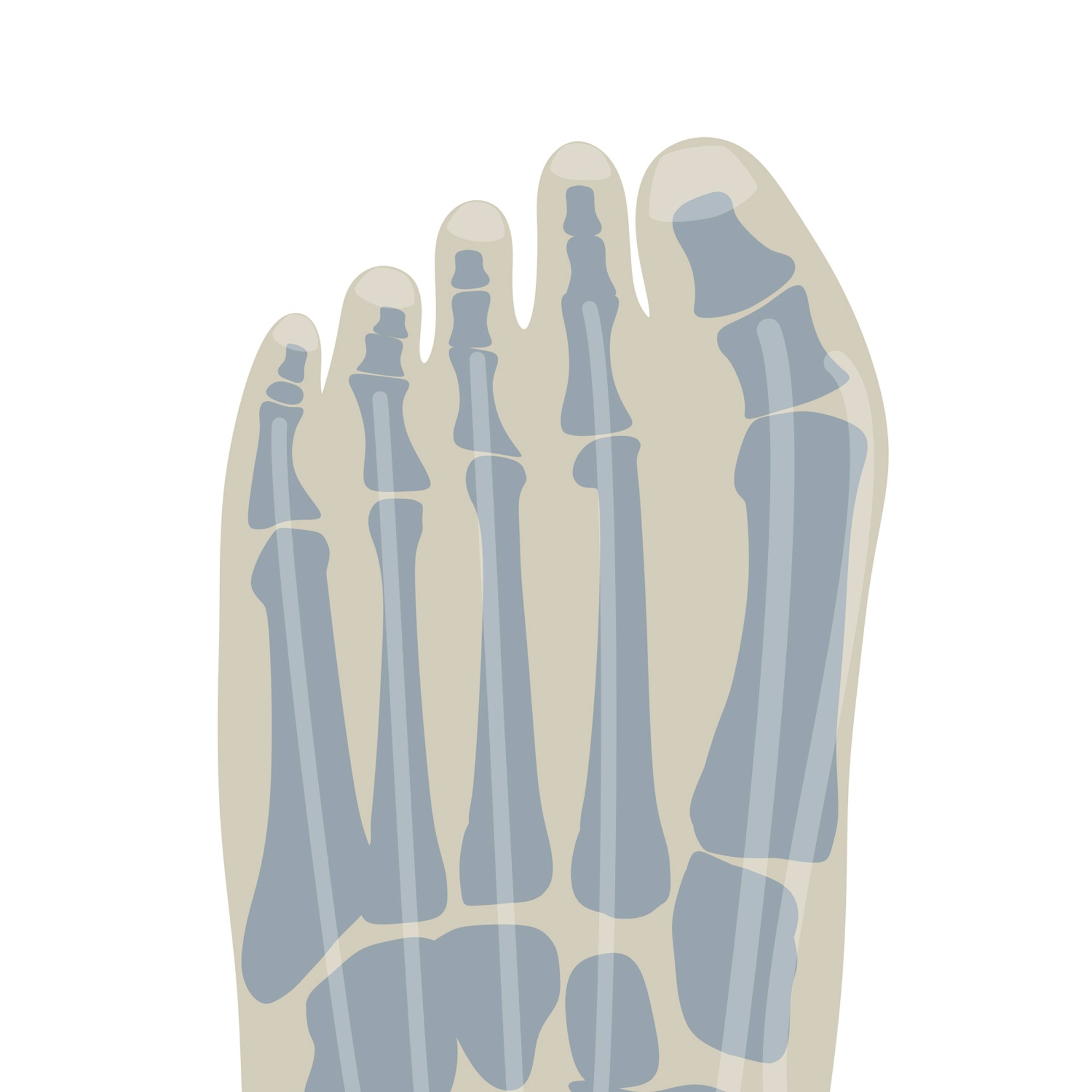 Wie_Schuhe_die_Bildu_50090310