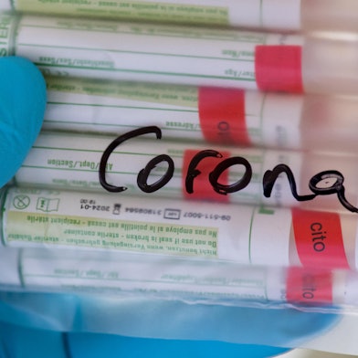 Coronavirus_Test