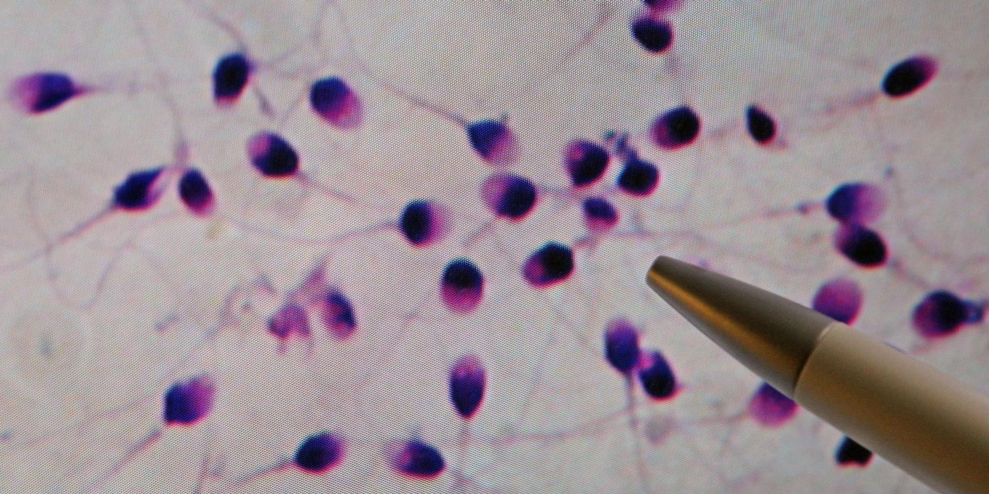 Spermiogramm Symbolbild dpa