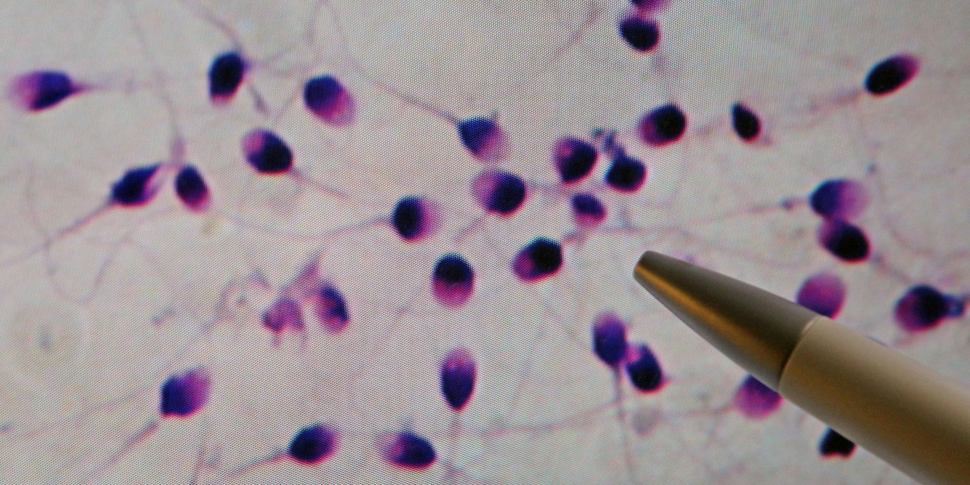 Spermiogramm Symbolbild dpa