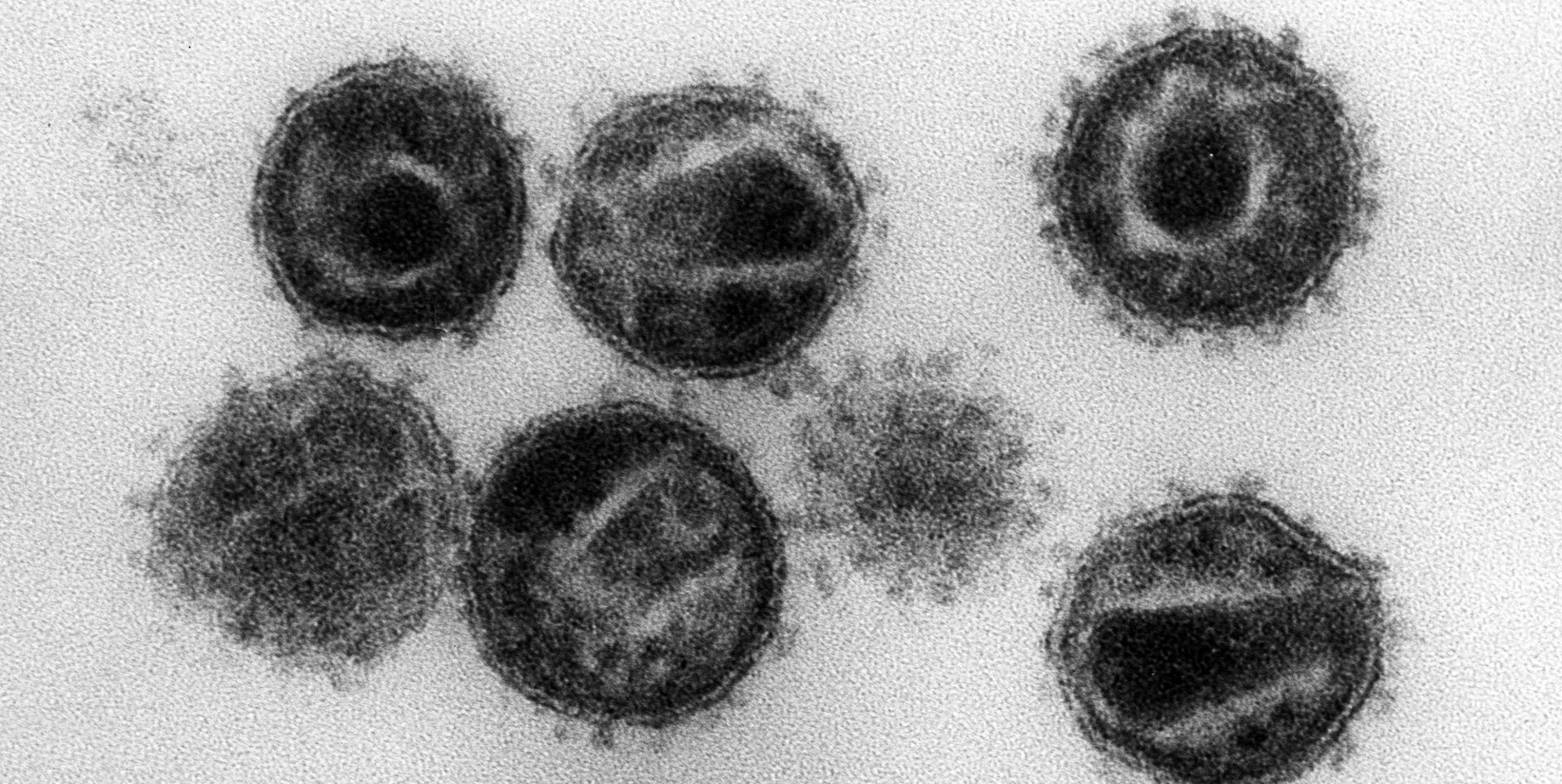 Hiv Virus