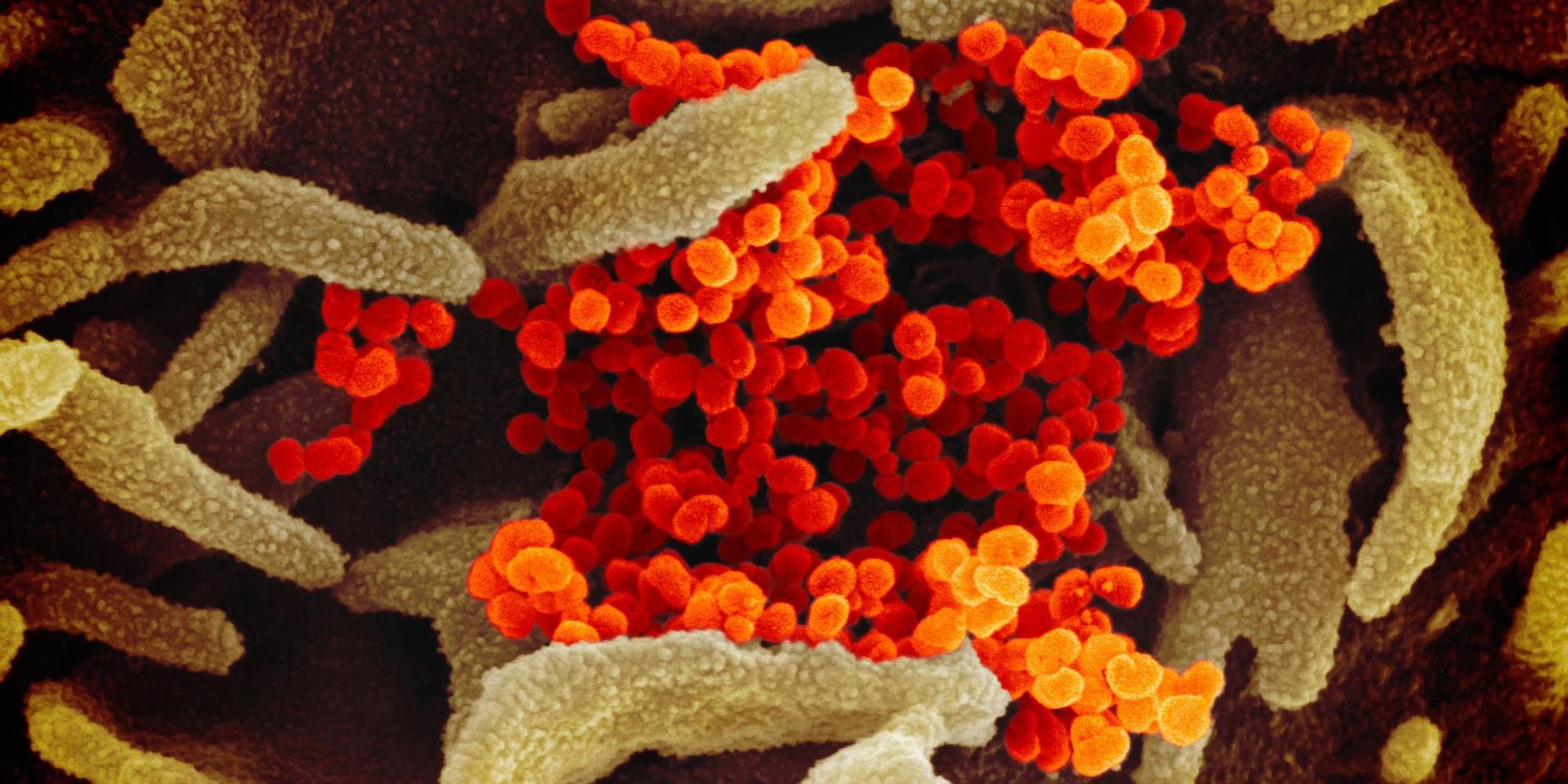 20200303coronavirus-003