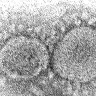 SARS-Cov-2 Schwarz weiß Elektronenmikroskop