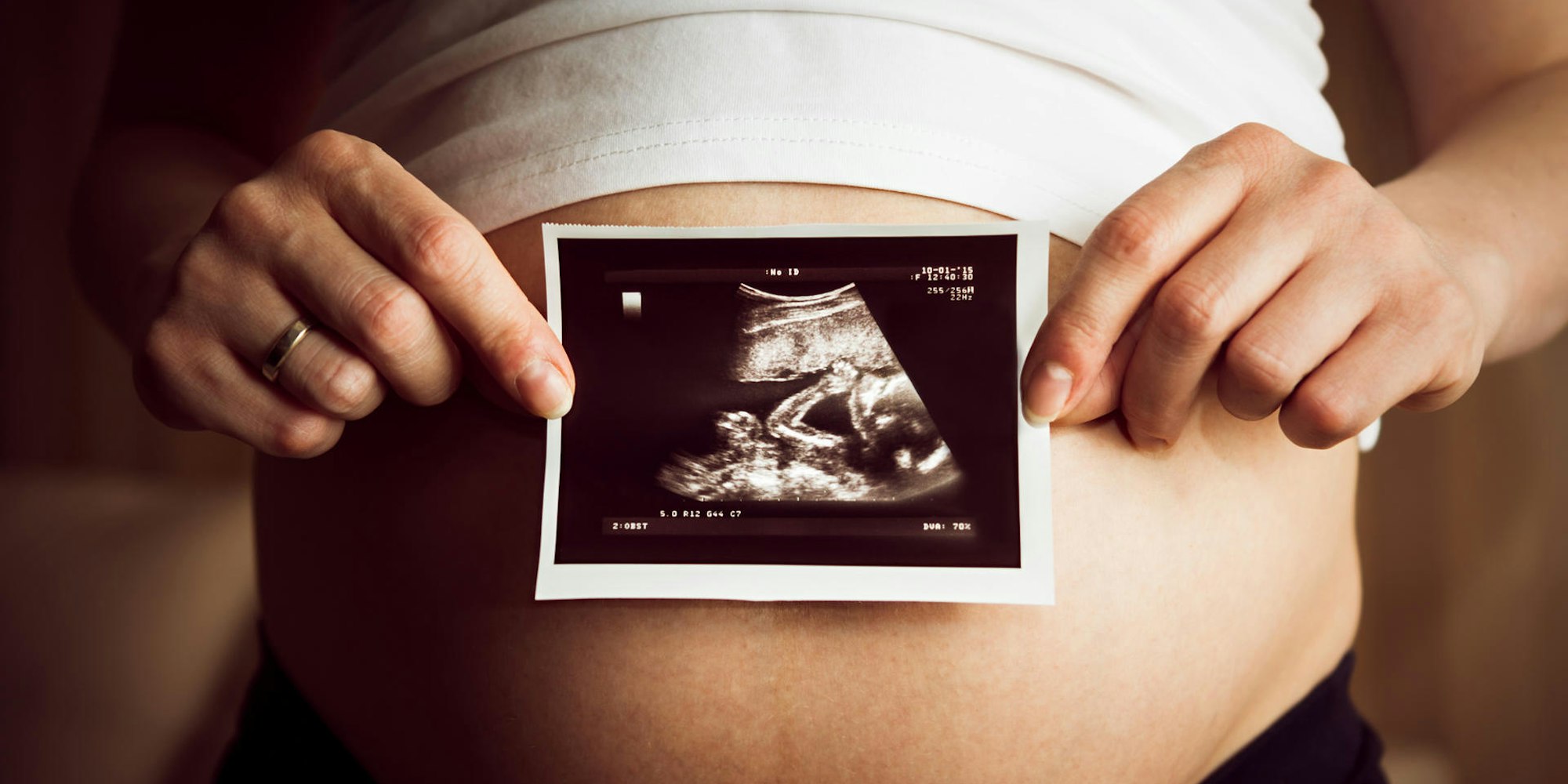 GettyImages-477718252